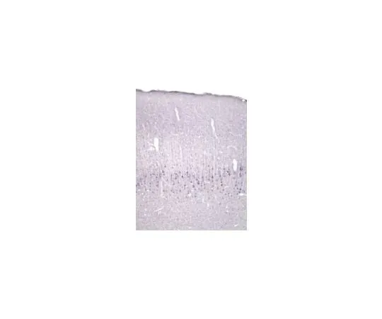 62-8445-74 Anti-Neurotrophin 4/5; 500 μg AB1781SP