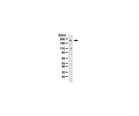 62-8385-35 Anti-SNF2β/BRG1; 200 μL 07-478