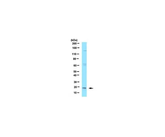 62-8458-26 Anti-dUTPase ABC457