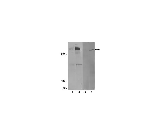 62-8372-67 Anti-phospho-ATM (Ser1981), clone 10H11.E12; 200 μg 05-740