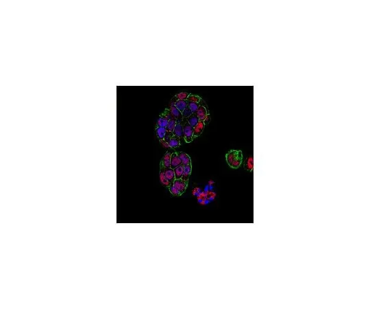 62-8382-38 Anti-Estrogen Receptor α (C1355) 06-935
