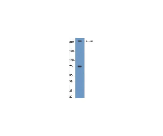 62-8367-97 Anti-BAF250a/ARID1a, clone PSG3; 100 μg 04-080