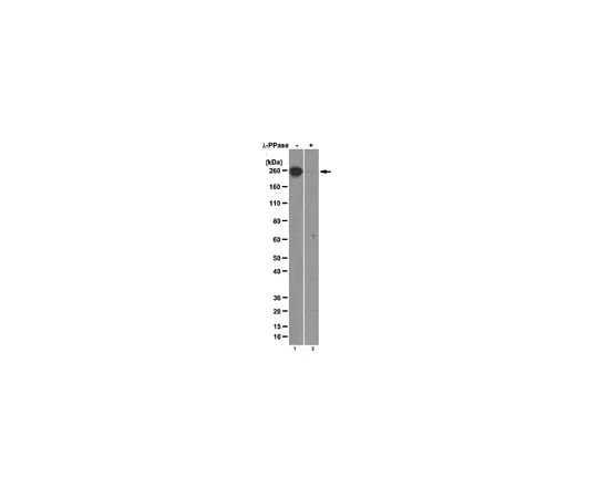 62-8369-46 Anti-RNA polymerase II subunit B1 (phospho-CTD Ser-7); 100 μg 04-1570