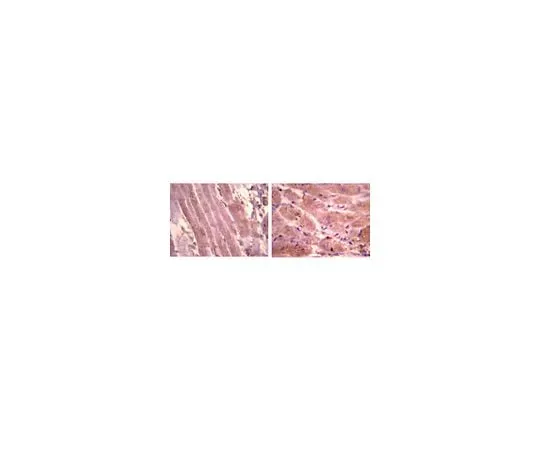62-8446-47 Anti-Atrial Natriuretic Polypetide, alpha; 100 μg AB2232