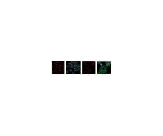 62-8462-88 Anti-Chromobox protein homolog 5 ABE1010