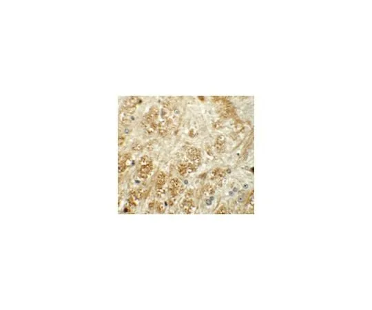 62-8467-47 Anti-ATP2C1 ABN479