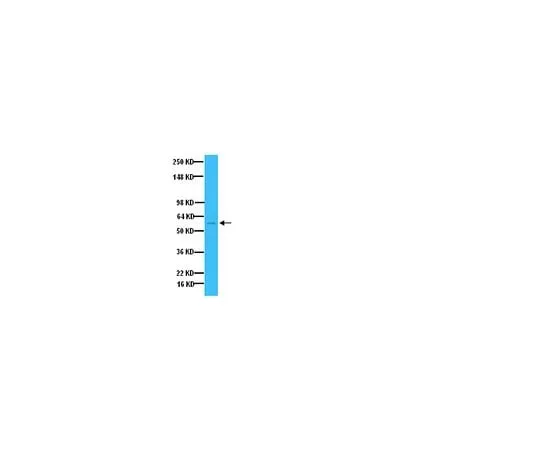 62-8445-19 Anti-Tyrosine Hydroxylase; 100 μL AB1542