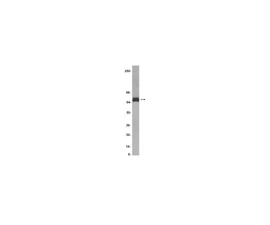 62-8383-95 Anti-Notch 4; 200 μg 07-189
