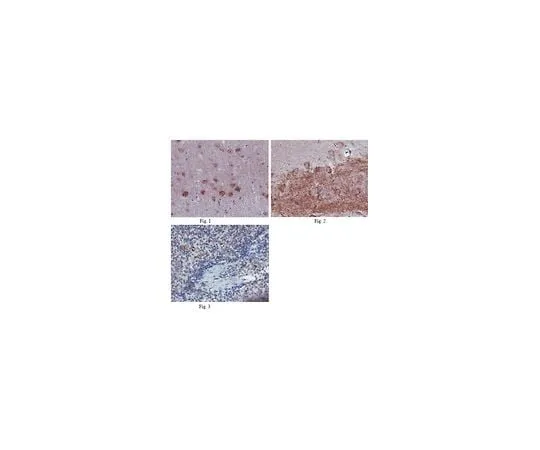 62-8466-11 Anti-C-X-C chemokine receptor type 5 (CXCR5) ABN200