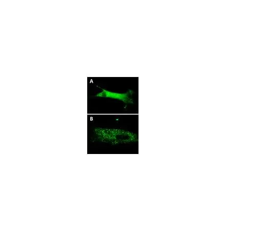 62-8394-61 LentiBrite(TM) GFP-p62 Lentiviral Biosensor 17-10224