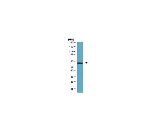 62-8387-85 Anti-Calcineurin Aα; 100 μL 07-1492