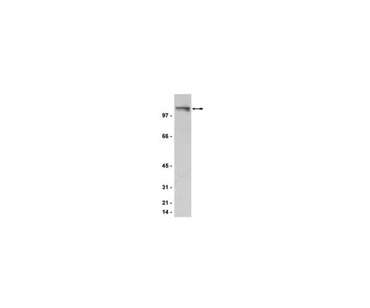 62-8372-56 Anti-PML, clone 36.1-104; 200 μg 05-718