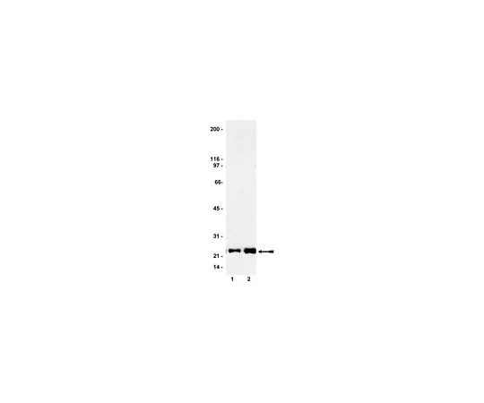 62-8393-09 Ras Activation Assay Kit; 1 kit 17-218