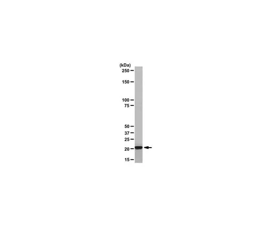 62-8368-53 Anti-Ha-Ras, clone MC57; 100 μl 04-775