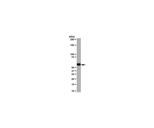 62-8368-62 Anti-Akt1/PKBα, clone AW24; 100 μl 04-796
