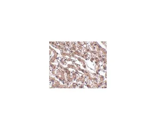 62-8458-98 Anti-MACC1 Antibody ABC851 ABC851
