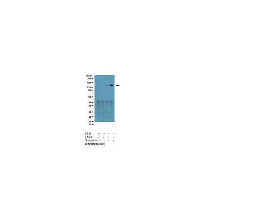 62-8387-34 Anti-phospho-JAK2 (Tyr317); 100 μL 07-1318