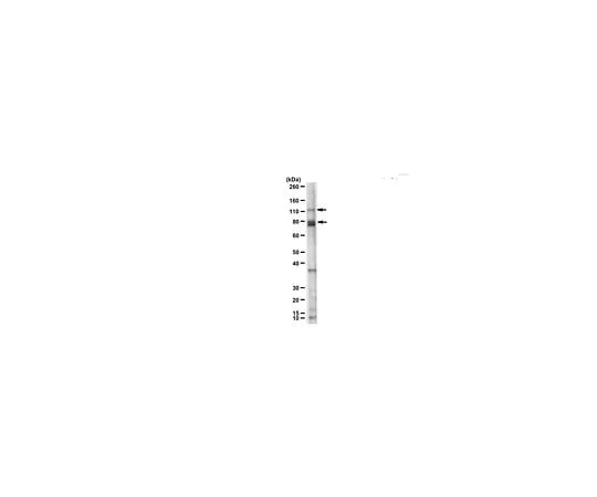 62-8467-25 Anti-Tau (T22), oligomeric ABN454 ABN454