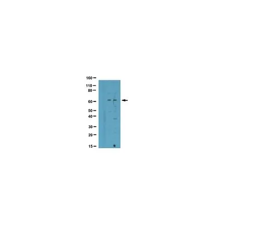 62-8387-52 Anti-oxidized-CaM Kinase II (Met281/282); 100 μL 07-1387
