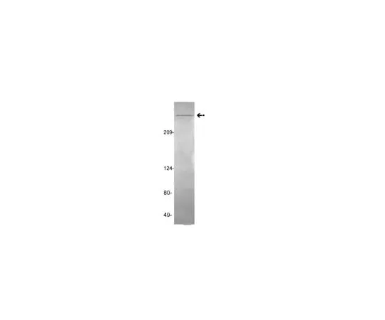 62-8373-47 Anti-vWF (von Willebrand Factor), clone GMA-022; 100 μg 05-861
