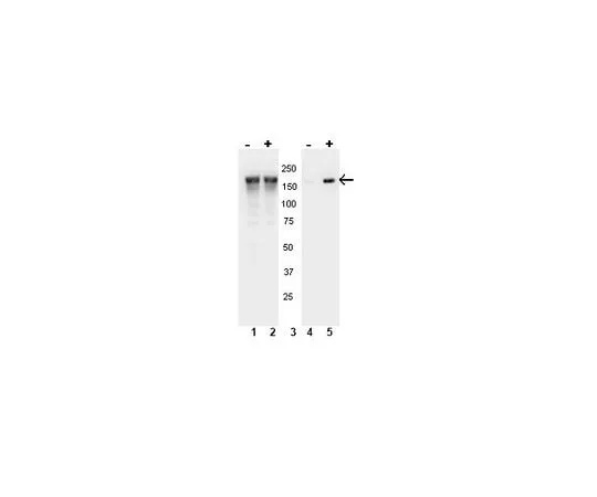 62-8386-71 anti-phospho-EGFR (Tyr1148); 100 μL 07-819
