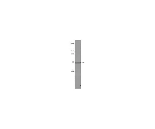62-8384-15 Anti-TACC2; 100 μg 07-228