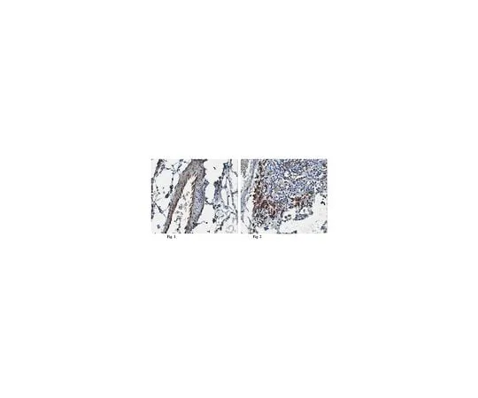 62-8456-55 Anti-Endostatin; 100 μg ABC60