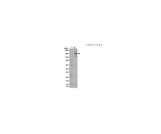 62-8386-81 Anti-phospho-IRS1 Antibody (Tyr941) 07-848-I