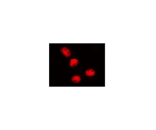 62-8394-64 LentiBrite(TM) Histone H2B-RFP Lentiviral Biosensor 17-10228