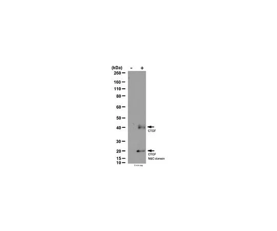 62-8387-51 Anti-Connective Tissue Growth Factor; 100 μg 07-1386