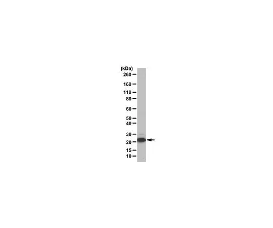 62-8458-36 Anti-phospho-Bad (Ser155) ABC467