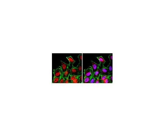 62-8388-28 Anti-FOXO3A; 100 μg 07-1719