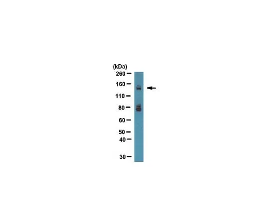 62-8452-35 Anti-Integrin alpha-11; 100 μg AB6031