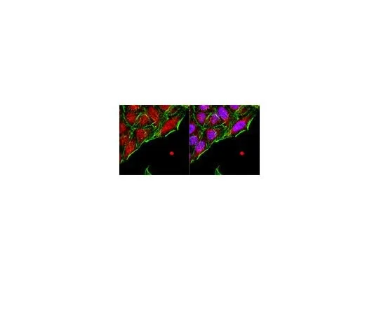 62-8452-13 Anti-Nkx-3.1; 100 μg AB5983