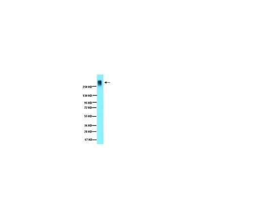 62-8444-72 Anti-Aggrecan; 50 μg AB1031