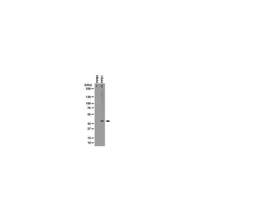 62-8369-17 Anti-methyl-PP2A, C subunit, clone 2A10 ; 150 μg 04-1479