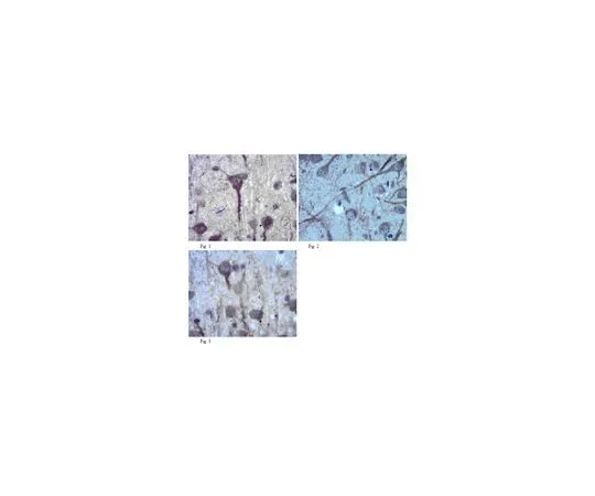 62-8465-74 Anti-Neurexin-1-alpha;100 μg ABN98