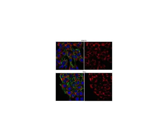 62-8460-10 Anti-PABPC1/C3; 100 μg ABE40