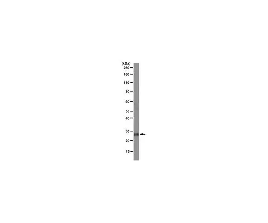 62-8369-05 Anti-Folr4 (Folate receptor 4), clone 5E12.2; 100 μg 04-968