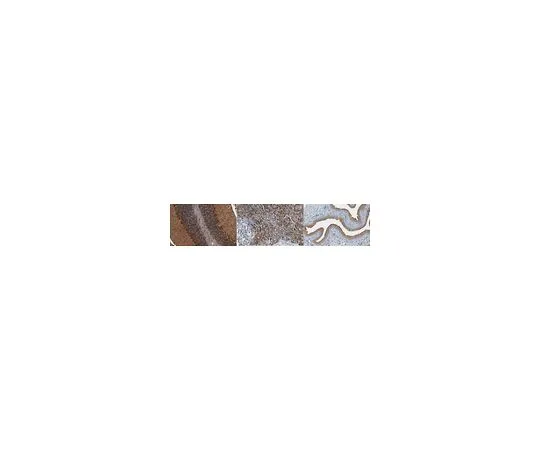 62-8524-76 Anti-SGK1, clone 1G2.1 MABS1476