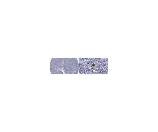62-8468-41 Anti-IAPP ABN1456