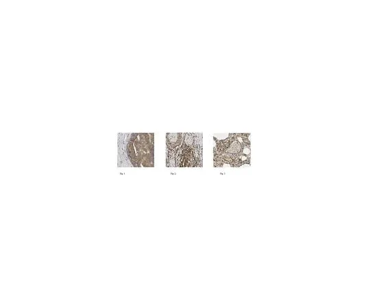 62-8491-71 Anti-Talin 1, clone TA205, N-term, Ascites Free MAB1676-C