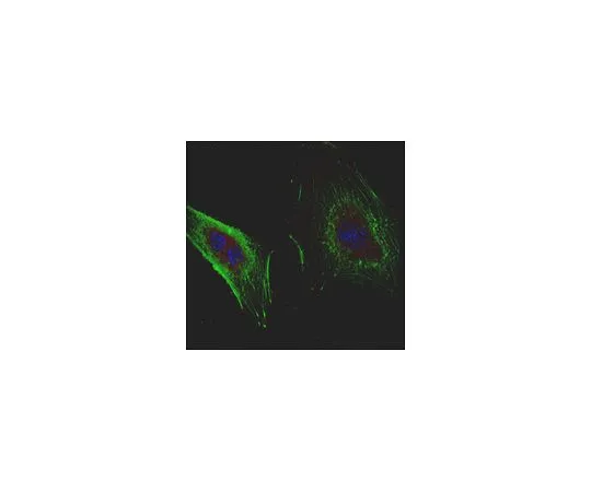 62-8523-88 Anti-Derlin-1 Antibody, clone 8G11.2 MABS1154