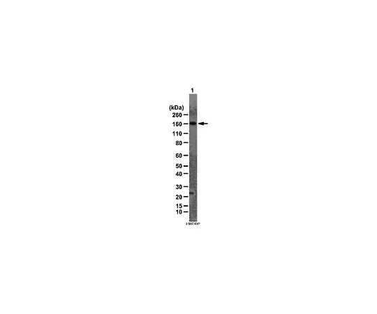 62-8469-14 Anti-AS160; 100 μg ABS54