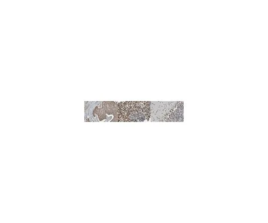 62-8508-34 Anti-SMARCA3 (HLTF), clone 11-1 MABE1074