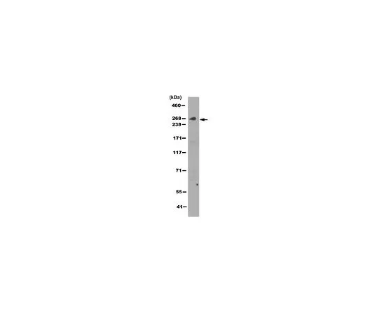 62-8520-83 Anti-IP3R3 Antibody, clone 6G12.1 MABN1544