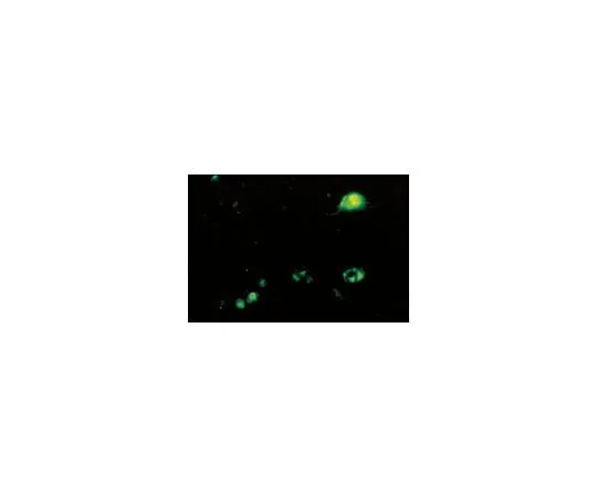 62-8490-13 Anti-Enterovirus 71, cross-reacts with Coxsackie A16, clone 422-8D-4C-4D; 100 μL MAB979