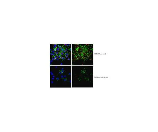 62-8469-60 Anti-phospho PDHE1-A type I (Ser300); 50 μg ABS194