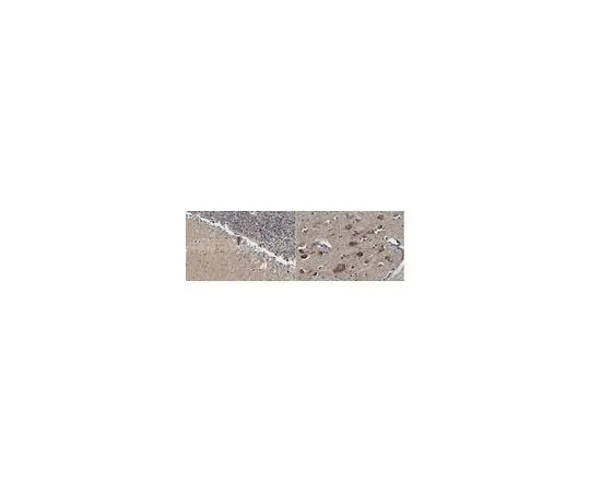 62-8468-47 Anti-Alpha 2b Adrenergic Receptor ABN1481