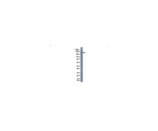 62-8468-70 Anti-Rootletin ABN1686